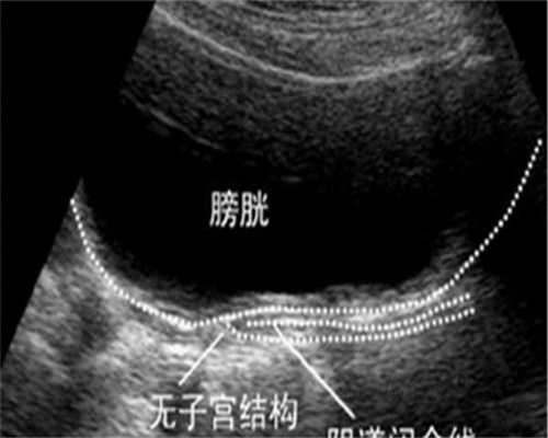 卵巢早衰